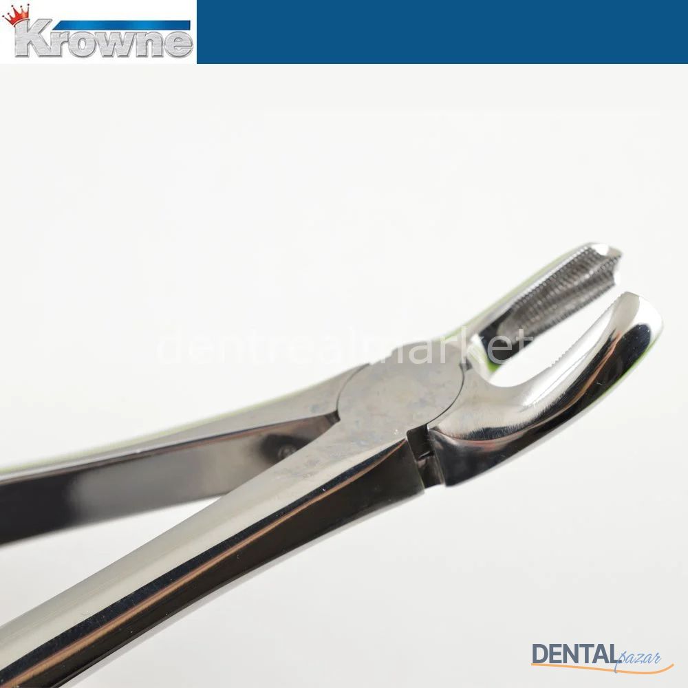 Davye Upper Molar Rights - 17