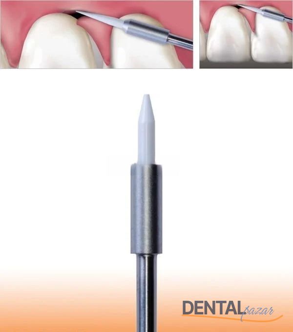Gingiva Trimmer Yumuşak Doku Frezi