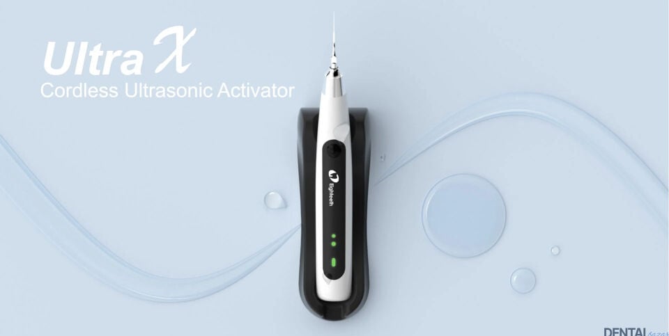 Ultra-X Ultrasonik Endo Aktivatör