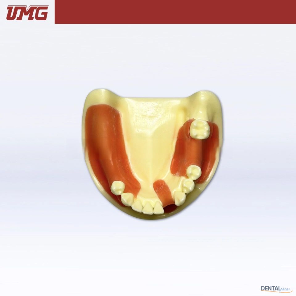 İmplant Eğitim Modeli Dişeti ile Birlikte