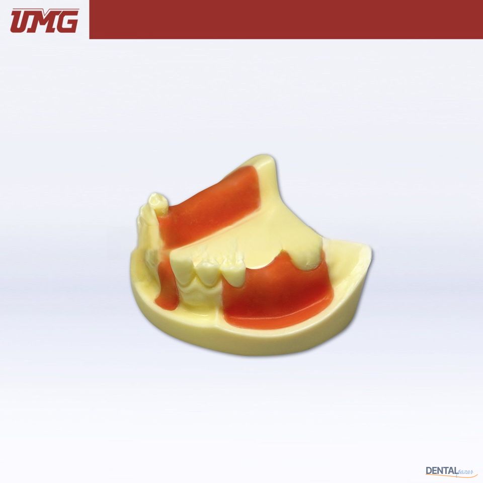 İmplant Eğitim Modeli Dişeti ile Birlikte
