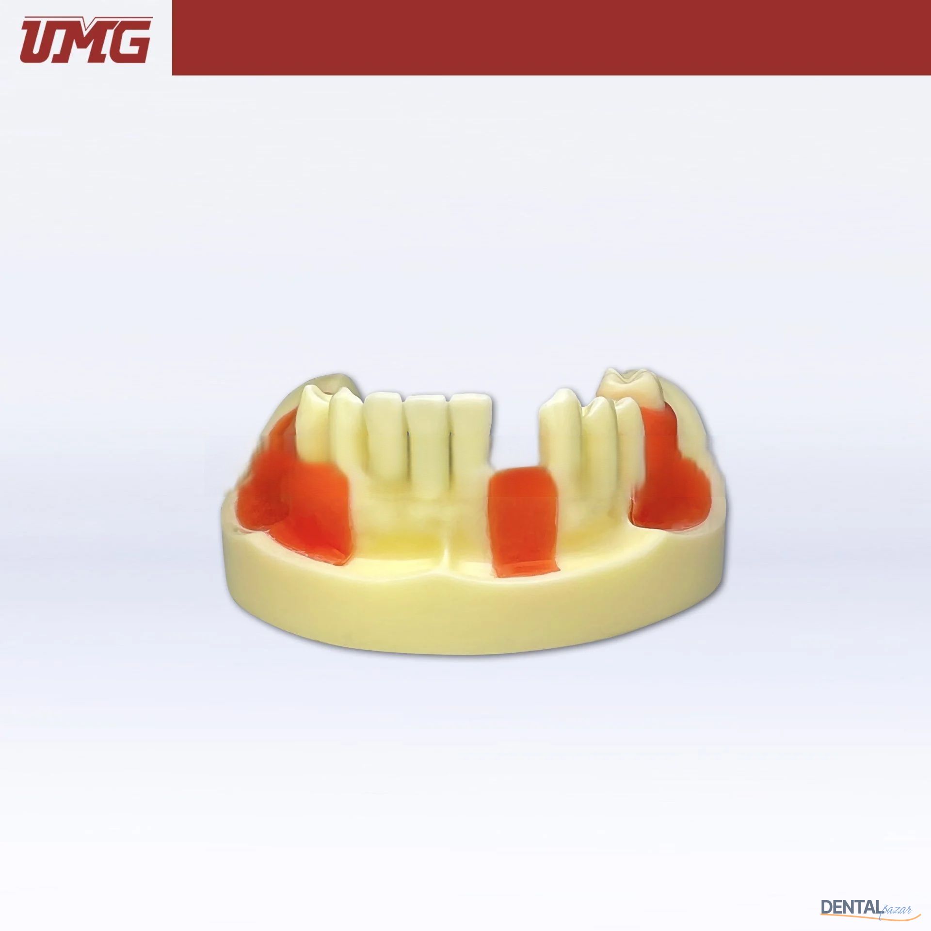 İmplant Eğitim Modeli Dişeti ile Birlikte