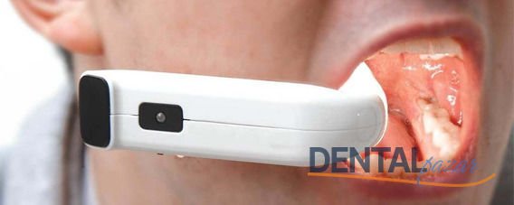 Işıklı Agız Ekartörü