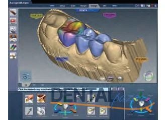 Arctica Cad- Cam Sistemi Full