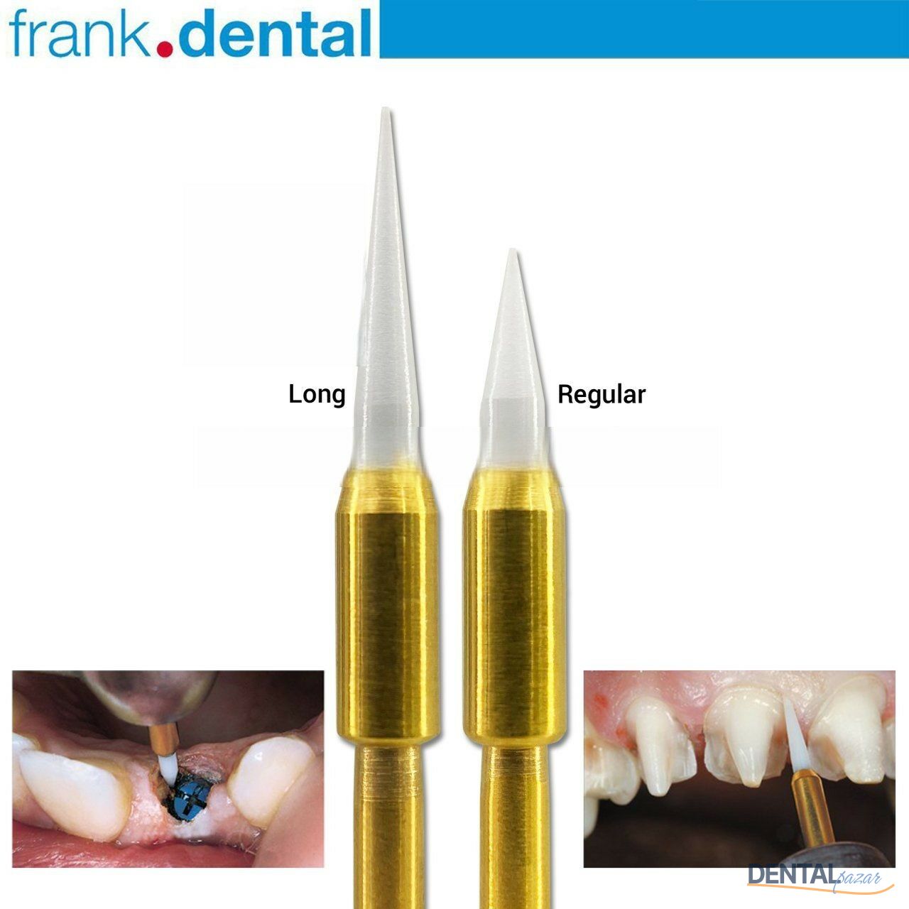Gingiva Trimmer Yumuşak Doku Frez Seti