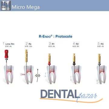 R-Endo InGeT Kanal Egesi